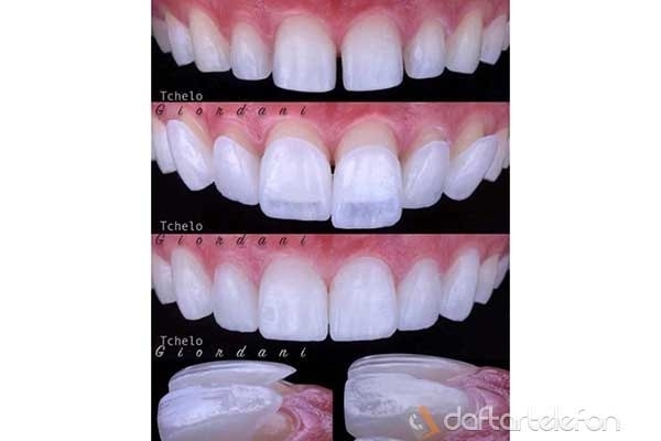 لابراتوارتخصصی پروتزهای دندانی پدیده البرز