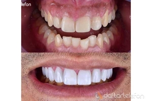 لابراتوارتخصصی پروتزهای دندانی پدیده البرز