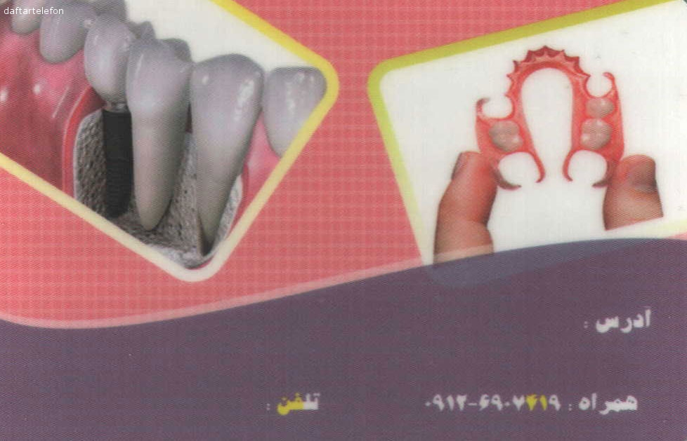 دندانسازی فدعمی
