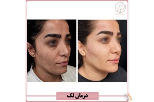 مرکز پوست و مو کاملیا