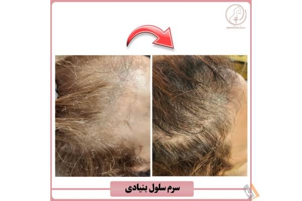 تصویری از مرکز پوست و مو کاملیا - تصویر 2