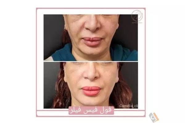 تصویری از مرکز پوست و مو کاملیا - تصویر 9