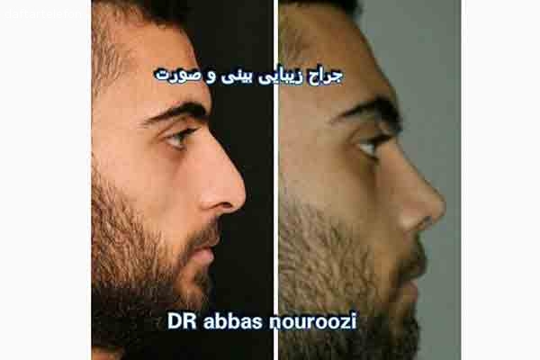جراح و متخصص گوش و حلق و بینی دکتر عباس نوروزی