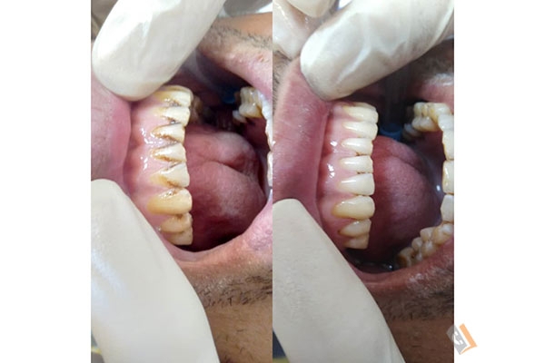 کلینیک دندانپزشکی روشا