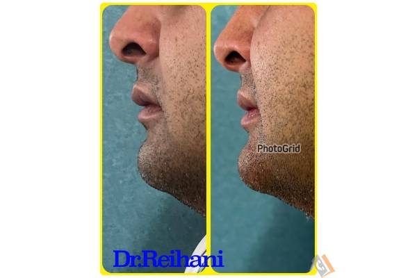 تصویری از کلینیک پوست و مو لیزر و لاغری دکتر سید تورج ریحانی - تصویر 10
