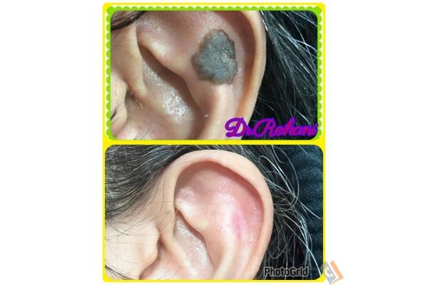 تصویری از کلینیک پوست و مو لیزر و لاغری دکتر سید تورج ریحانی - تصویر 11