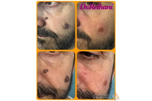 تصویری از کلینیک پوست و مو لیزر و لاغری دکتر سید تورج ریحانی - تصویر 6