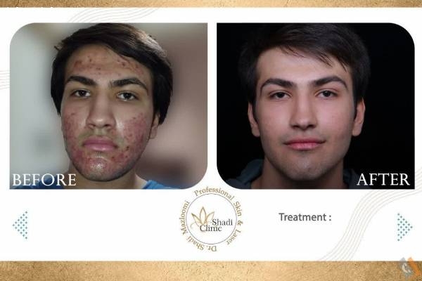 تصویری از کلینیک تخصصی پوست مو و لیزر دکتر شادی مظلومی - تصویر 10