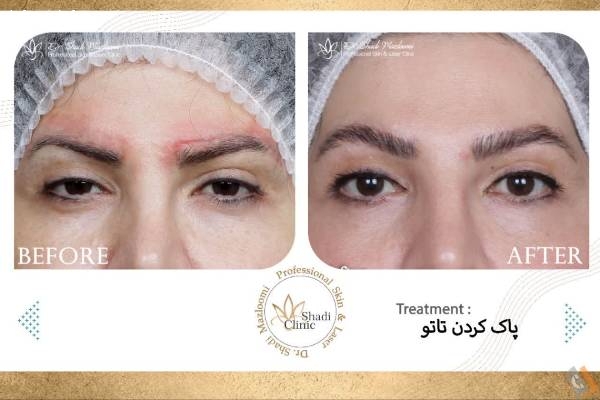 تصویری از کلینیک تخصصی پوست مو و لیزر دکتر شادی مظلومی - تصویر 3