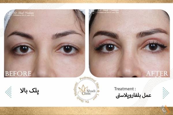 تصویری از کلینیک تخصصی پوست مو و لیزر دکتر شادی مظلومی - تصویر 4