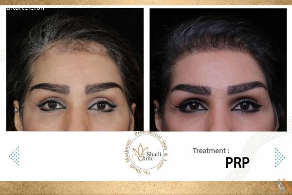 تصویری از کلینیک تخصصی پوست مو و لیزر دکتر شادی مظلومی - تصویر 9
