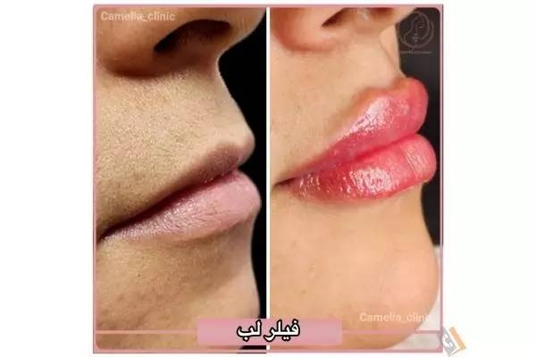 تصویری از مرکز پوست و مو کاملیا - تصویر 10