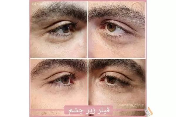تصویری از مرکز پوست و مو کاملیا - تصویر 11