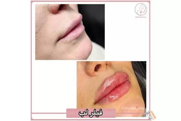 تصویری از مرکز پوست و مو کاملیا - تصویر 12