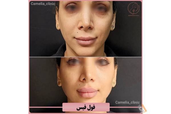 تصویری از مرکز پوست و مو کاملیا - تصویر 4