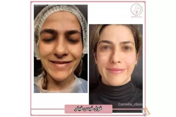 تصویری از مرکز پوست و مو کاملیا - تصویر 5