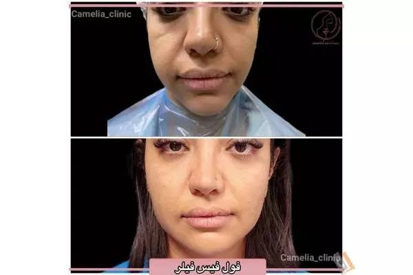 تصویری از مرکز پوست و مو کاملیا - تصویر 6