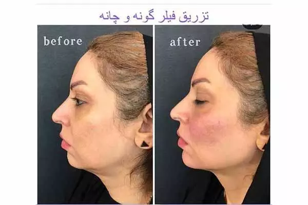 مطب دکتر غلامرضا رحیمی پور