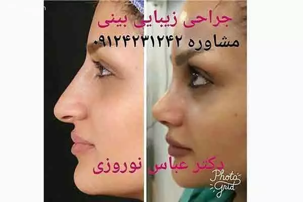 مطب دکتر عباس نوروزی