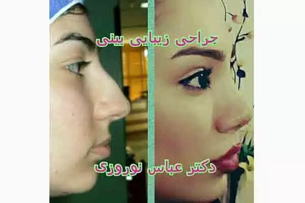 جراح و متخصص گوش و حلق و بینی دکتر عباس نوروزی