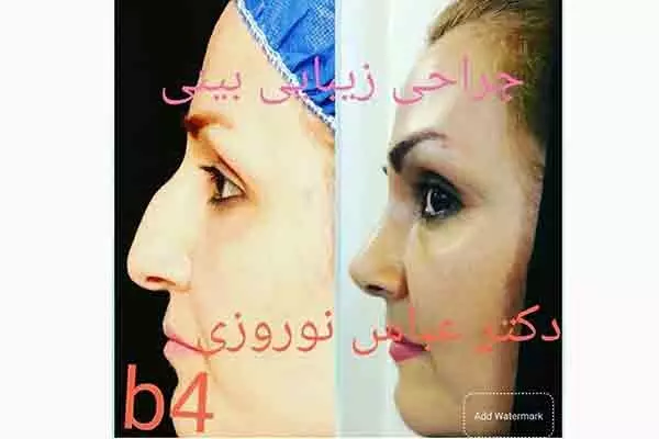 جراح و متخصص گوش و حلق و بینی دکتر عباس نوروزی