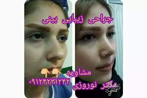 جراح و متخصص گوش و حلق و بینی دکتر عباس نوروزی