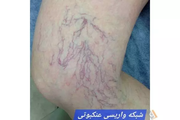 تصویری از مرکز درمان واریس البرز - تصویر 7